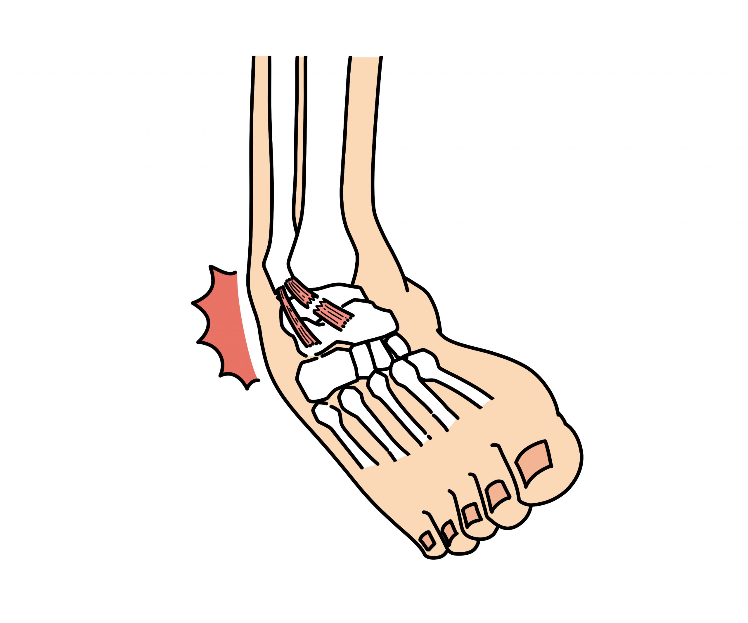 スポーツ外傷や転倒による怪我も対応 再発予防までサポート 画像